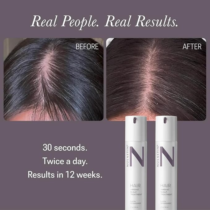 NULASTIN Scalp Serum - Vibrant Scalp Treatment to Help Improve the Look of Hair Density - Lightweight, Fast Absorbing Formula Enriched with Hair-Strengthening Ingredients (1.7 Oz)