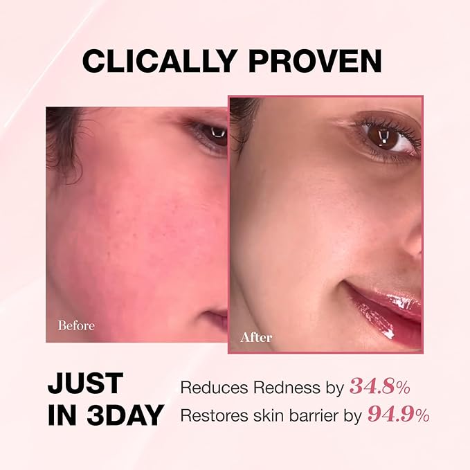 Physiogel Redness Reducing Cream – Ceramide Moisturizer for Dry, Sensitive & Redness-Prone Skin, Repairs Skin Barrier, Dermatologist-Tested, Fragrance-Free, Korean Skincare, 3.4 fl oz