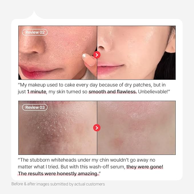 Parnell AHA 9.12% Omija Ceramic Wash-Off Serum | 1-Minute Face Exfoliation for Sebum Control & Smooth Texture | PHA BHA LHA Vitamin C K-Care (1.01 fl oz)