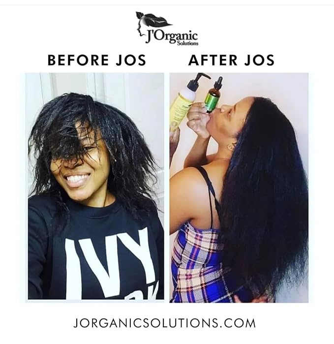 J'Organic Solutions Growth-Plus Scalp Nourishing Oil (4 Oz)