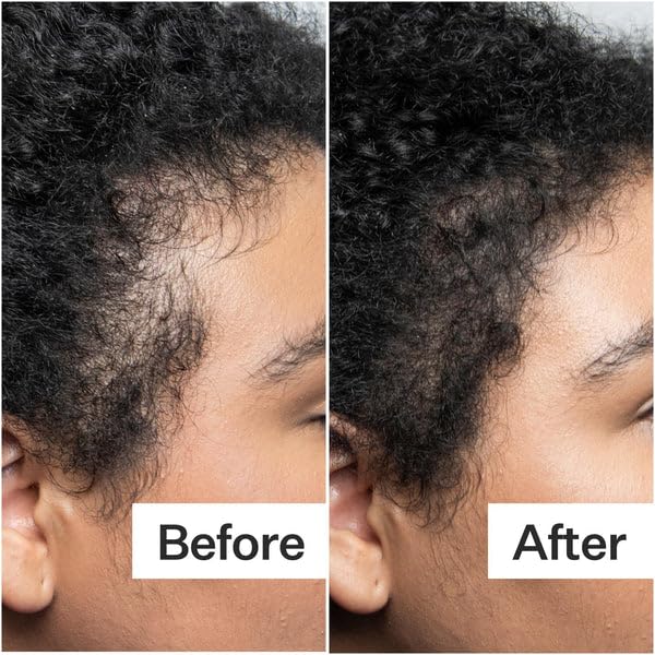 Chebe Hair Growth Oil, 52 in 1 Scalp stimulator for Rapid and Extreme Growth on bald spots, Edges. Thicknens Hair folicles in just couple uses. 5oz/150ml