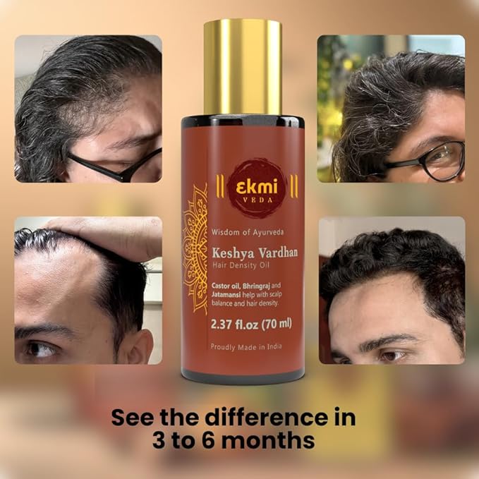 Ayurvedic Castor & Rosemary Oil For Hair Density With Bhringraj, Coconut, Amla, Argan, Brahmi. DHT Blocker. Hair Loss Treatment For Women & Men, 2.37 Fl Oz