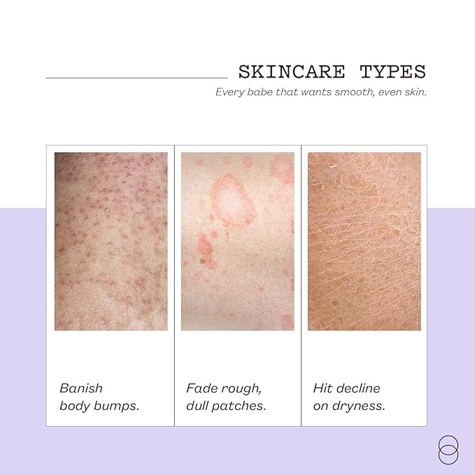frank body Niacinamide Body Scrub | Fights Breakouts & Dryness | Exfoliating Body Scrub | Berry Extracts & Green Tea | Berry Scent | Vegan & Cruelty Free | 250g / 8.82 oz