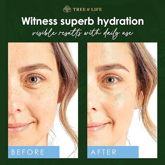 Tree of Life Beauty Hyaluronic Acid Serum, Skin Brightening Face Oil for Dark and Age Spots, Facial Serums for Dry and Sensitive Skin Care with Vitamin E for Soft Smooth Skin, 2 Fl Oz