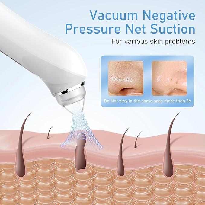 Facial Pore Blackhead Remover Vacuum, 1080P Camera Blackhead Remover, 20x Zoom, 8 LEDs ＆ 3 Suction Modes, 800mAh Battery & USB - 6 Heads Pore Cleaner Kit for Women&Men(White)