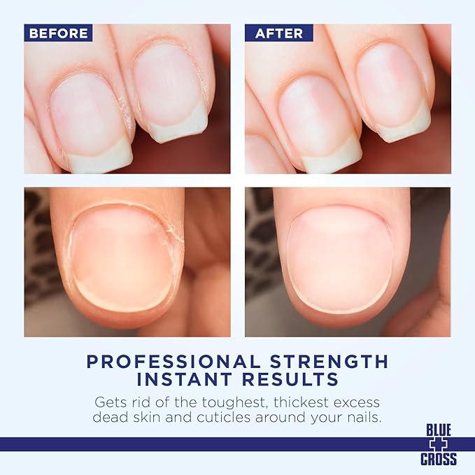 Blue Cross Professional Nail + Cuticle Care 2 Pack Bundle, Liquid Cuticle Remover + Softener & Cuticle Nippers, Cutter & Trimmer for Fingernails and Toenails