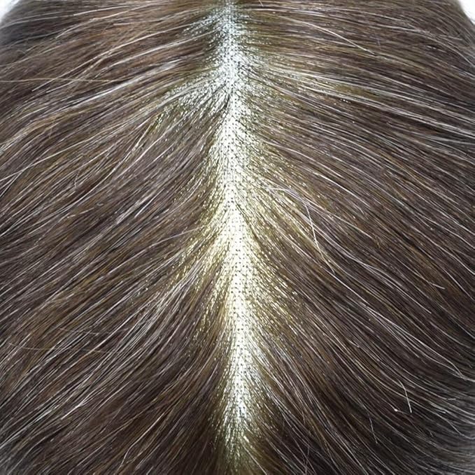 FACE MIRACLE Mens Toupee Lace Front Hairpieces Soft Human Hair Replacement System Natural Hairline Toupee for Men French Lace Poly V-Looped Mens hair Units 7"X9" #350 Dark Brown with 50% Gray