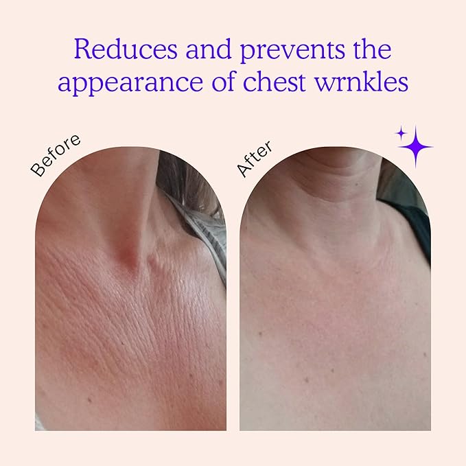 BLUMBODY Chest Wrinkle Pads – Anti-Wrinkle Silicone Patches Skin Firming, Smoothing – Reusable Overnight Chest Patches – Anti-Aging Crepe Erase Pads – Neck, Décolleté (2-Month Supply)