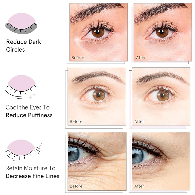 grace & stella Award Winning Under Eye Mask - Travel Essentials - Birthday Gifts for Women - Gel Eye Patches for Dark Circles, Puffy Eyes, Wrinkles, Undereye Bags - Vegan - Self Care (24 Pairs, Gold)