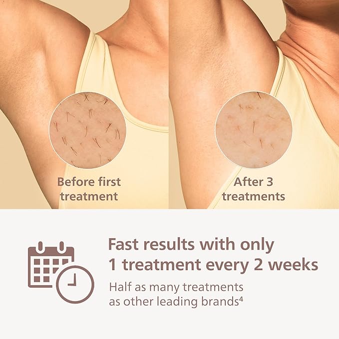 Philips Lumea 7000 Series IPL Hair Removal Device - Permanent Visible Hair Reduction Done at Home, SenseIQ Technology, Uniquely Curved Attachment for Body, for Women & Men, BRI931/03
