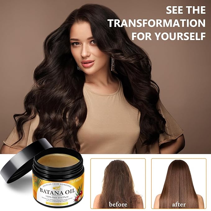Raw Batana Oil for Hair Growth, 100% Pure, Dr. Sebi Batana Oil from Honduras, Organic, Unrefined, Prevents Hair Loss, Hair Care, Enhances Hair Thickness in Men & Women 4.2 oz