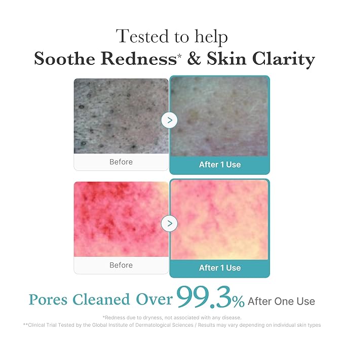 medicube Azelaic Acid Gummy Whip Cleanser | Cleansing Foam For Troubled Skin | Use After Spot Care & Excess Sebum Control | Niacinamide, Glycerin | Soothing, Pore Cleansing Face Wash | Korean Skincare