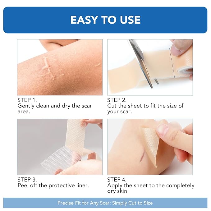 Silicone Scar Sheets, Silicone Scar Tape(1.6"x 120" Roll-3M) - Reusable, Soft & Medical Grade Adhesive Tape for Old & New Scars, C-Section, Surgery, Keloid & Acne Scars
