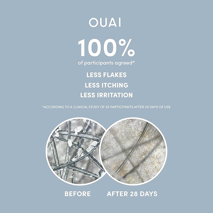 OUAI Detox Shampoo (10 fl oz) & Anti-Dandruff Deluxe Size (1 fl oz) Bundle - Soothing, Clarifying Shampoo Set for Dry, Flaky Scalp - Removes Dirt & Build Up (2 Count)