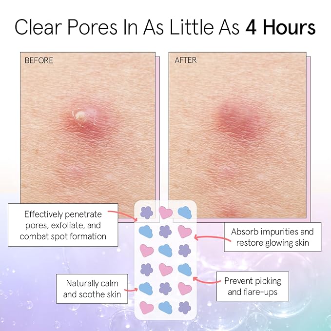 grace & stella Award Winning Pimple Patches for Face - Dermatologist Tested Acne Patches - Hydrocolloid Patch for Breakouts, Whiteheads - Vegan Acne Spot Treatment for Face (Multishape, 144 Count)