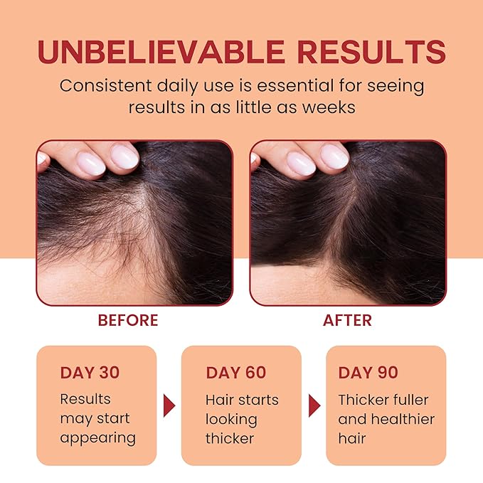 Raw Batana Oil for Hair Growth - 100% Pure, Organic 4oz Batana from Honduras for Thick and Strong Natural Hair - Dr. Sebi Unrefined Cold Pressed Cosmetic Scalp Mask for Men & Women (3 Pack)