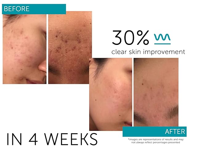 FACTORFIVE Regenerative Serum with Stem Cell Growth Factors, HGF for Skin Tightening and Smoothing, Wrinkle and Pore Reduction, and Rejuvenation - 1 fl oz/30ml