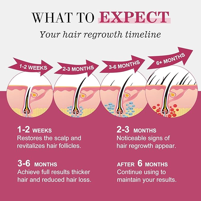 5% Minoxidil for Women Hair Regrowth Spray, hers hair regrowth treatment Infused with Biotin, Extra Strength Treatment to Combat Hair Loss and Thinning, 3 Bottles