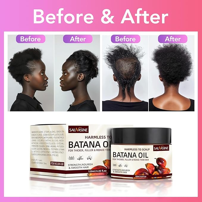 Lanthome Batana Oil for Hair Growth, Natural Dr. Sebi Hair Oil - Prevents Hair Loss, Eliminates Split Ends, Repairs Damaged Hair, Nourishes, for Men & Women- 120mL (4.05 Fl Oz)