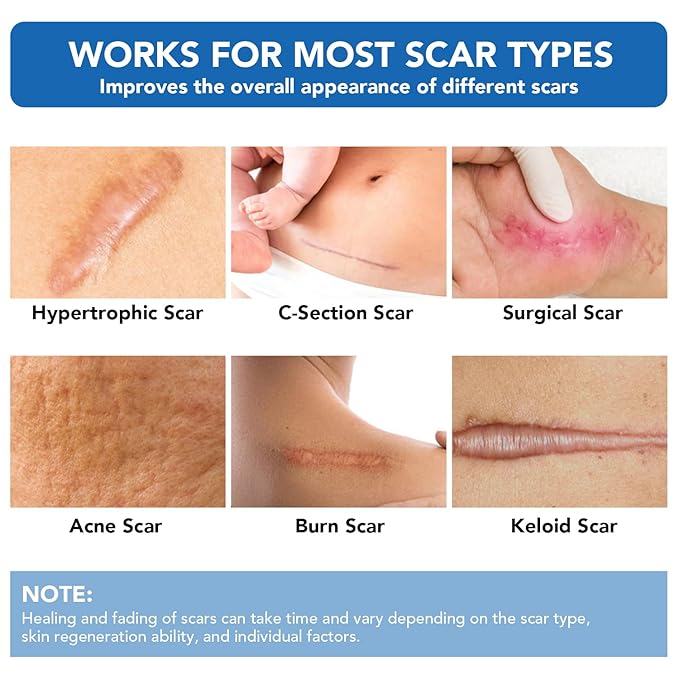 Silicone Scar Sheets, Silicone Scar Tape(1.6"x 60" Roll-1.5M) - Reusable, Soft & Medical Grade Adhesive Tape for Old & New Scars, C-Section, Surgery, Keloid & Acne Scars