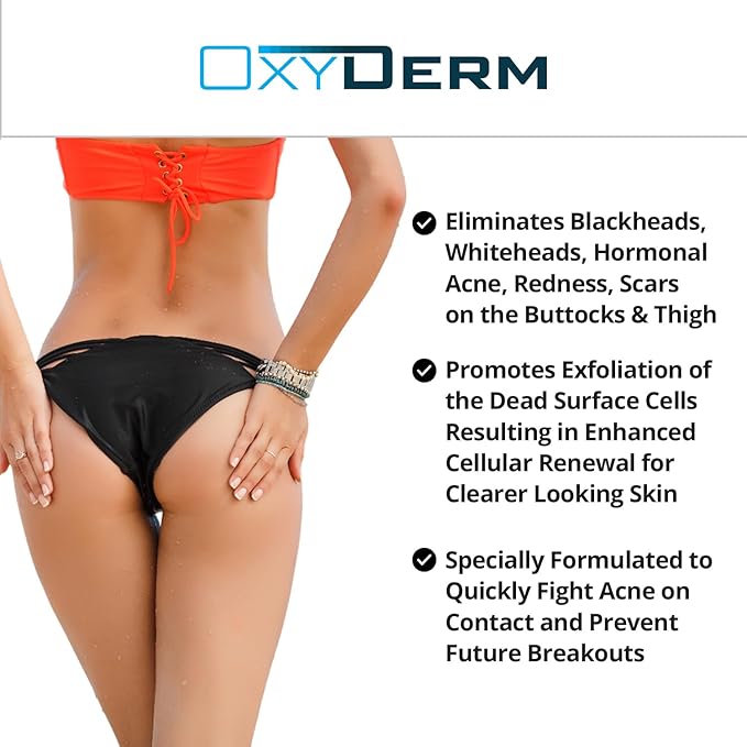 Butt & thigh Acne Treatment Pads - Exfoliating Pads to Eliminate Acne Causing Bacteria. Removes Pimples, Blemishes & Ingrown Hairs for the Buttocks & Thigh Area for Both Men & Women.