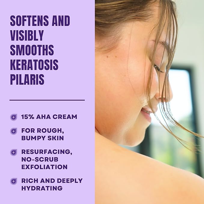 AmLactin KP Bumps Be Gone - Therapeutic Body Cream for Keratosis Pilaris - No-Scrub Exfoliator and Moisturizer with 15% Lactic Acid AHA, 3 oz (Packaging May Vary)