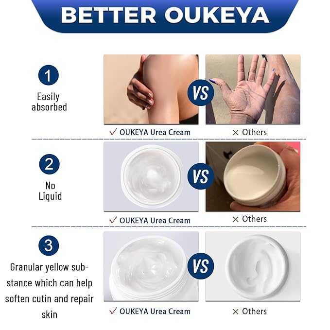 OUKEYA Urea Cream 40 Percent, Foot & Hand Cream for Dry Cracked, Urea Lotion for Feet Maximum Strength(12.35Oz)