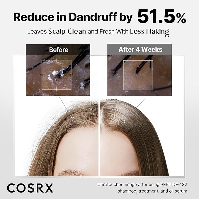 COSRX PEPTIDE 132 Hair Bonding Shampoo - Daily Scalp Treatment for Dandruff, Dry, Itchy or Flaky Scalp - Repairs & Strengthens Damaged Hair with Caffeine & Zinc PCA, For All Hair Types – 6.76 fl oz