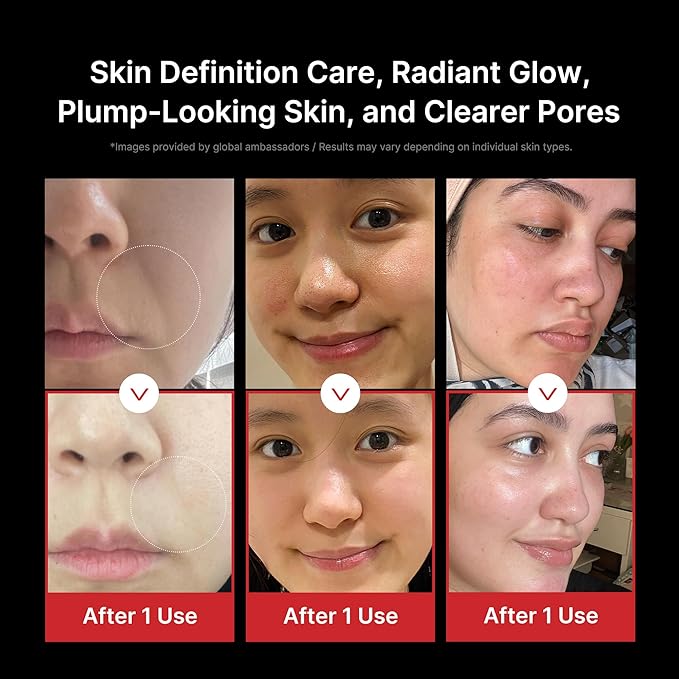 medicube Age-R Booster Pro | 6-in-1 Real Glass Glow Beauty Massager | Looking Glass Skin | Korean Skin Care