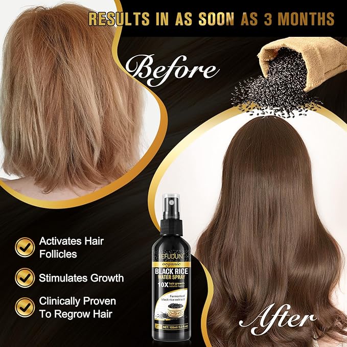 Organic Black Rice Water Spray for Hair Growth, A Solution with Castor Oil & Ginger Root Extract for Thicker, Fuller Hair, Targets Hair Loss and Repairs Damage 100ml/3.2 fl.oz (1 PC)