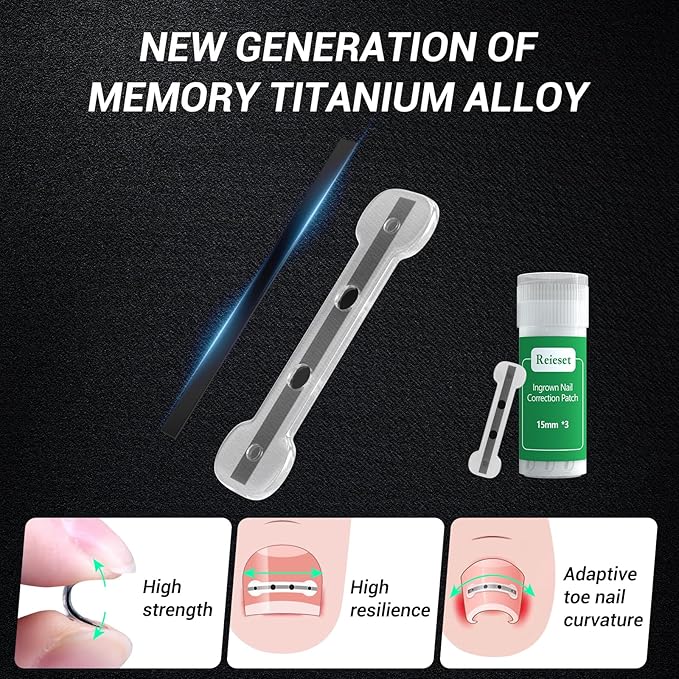 Titanium Alloy Ingrown Toenail Treatment, Nail Tools, and Ingrown Toenail Removal Kit Specially Designed for Curved Nail Repair and Ingrown Toenail Corrector (0.59/0.67in)