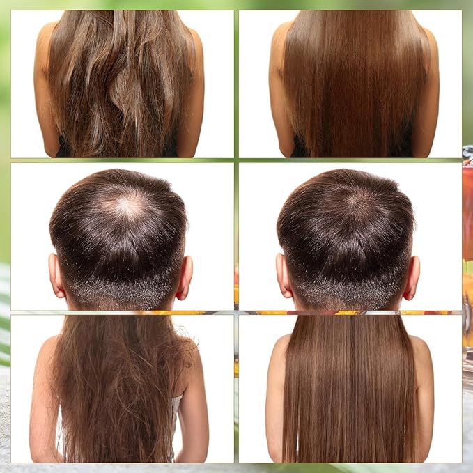 Batana Oil for Hair Growth, Natural Hair Growth Oil, Prevent Hair Loss and Enhances Thickness, Batana for Hair-Thickness, Nourishes and Strengthens