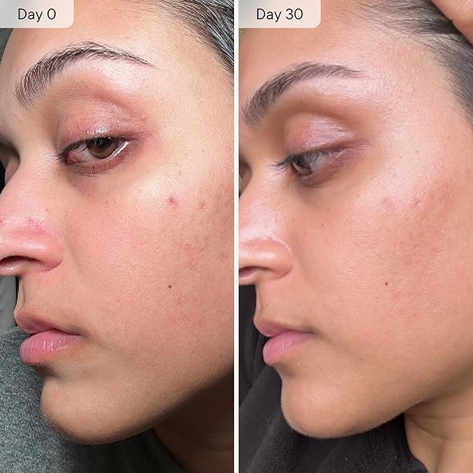 Qure Micro Infusion System for Face & Neck - Facial Moisturizing Essence, Even-looking tone, Serum for All Skin Types, Refreshed and Luminous Skin - 1-Month Supply