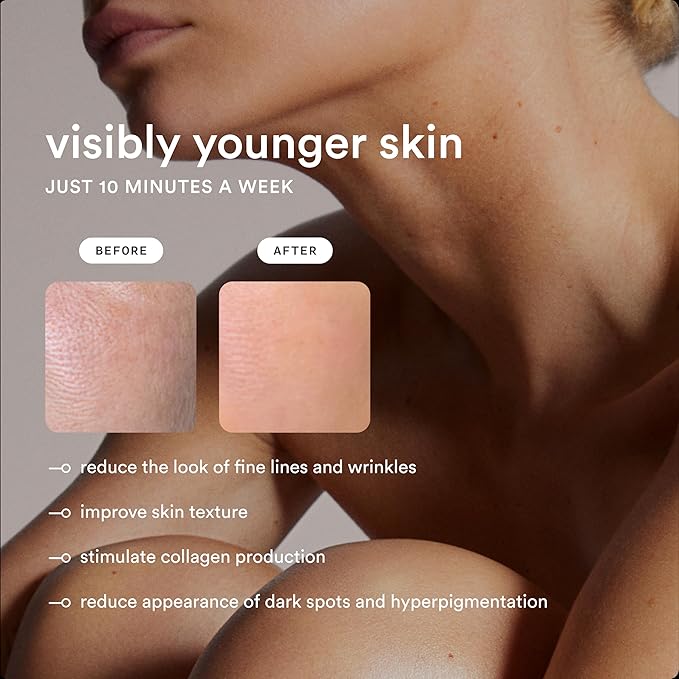 Nood™ Flasher Pro — IPL Laser Hair Removal Device & Anti-Aging Red Light Therapy for Women & Men — Pain-free & Permanent, Visible Results After First Use & Works Everywhere Hair Grows — Matte Black