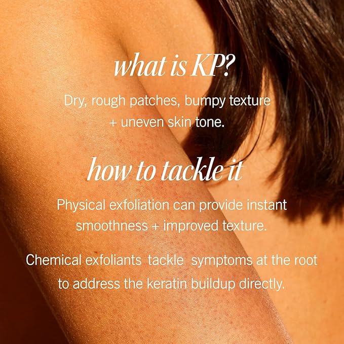 First Aid Beauty - KP Bump Eraser Body Scrub with 10% AHA, Keratosis Pilaris Exfoliator with Glycolic and Lactic acids, Helps Reduce Chicken Skin Bumps, Safe for Sensitive Skin, Peach Scent (2 oz)