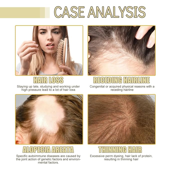 Rosemary Hair Growth Oil for Dry, Damaged & Thin Hair, Nourishing Unisex Formula (3 x 60ml)