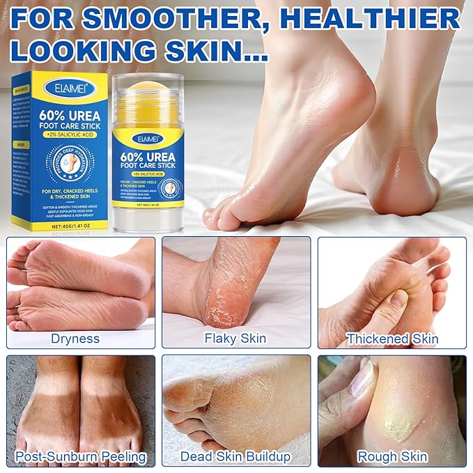 60% Urea with 2% Salicylic Acid Urea Foot Care Stick, 2PCS Heel Stick for Cracked Feet, Foot Care Cream Moisturizer for Dry Cracked Feet, Knees, Elbows, Hands, Foot Lotion Stick