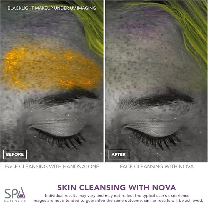 Spa Sciences - NOVA - Sonic Cleansing Brush with Bristles & Infusion System – Anti-Aging Facial Exfoliating, Waterproof, and USB Rechargeable