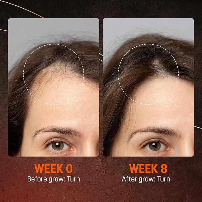 Abera Hair Growth Serum for Hair Loss, Natural Hair Regrowth Treatment for Hair & Beard with Biotin & Castor Oil, Recommended Combo (1 Serum + Gift)