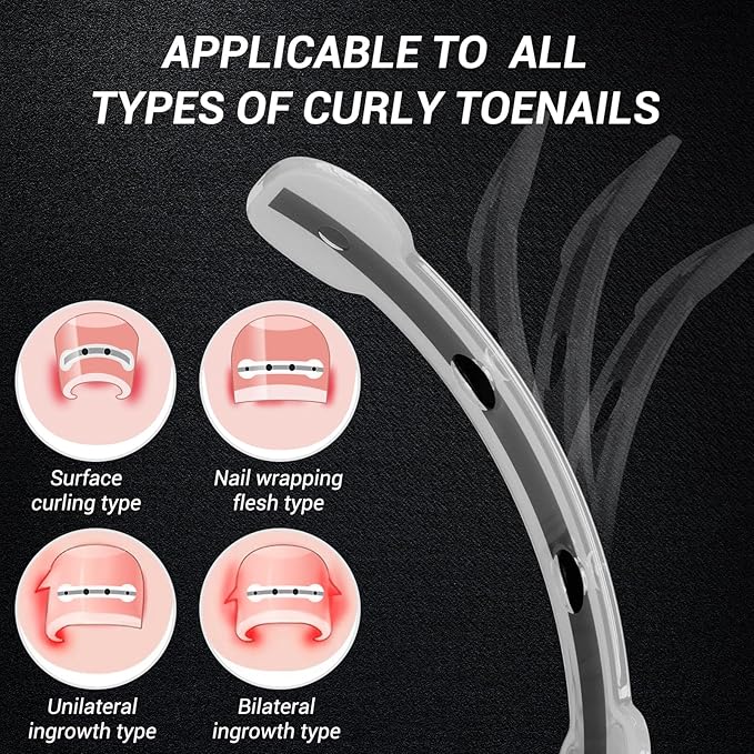 Titanium Alloy Ingrown Toenail Treatment, Nail Tools, and Ingrown Toenail Removal Kit Specially Designed for Curved Nail Repair and Ingrown Toenail Corrector (0.67/0.79in)