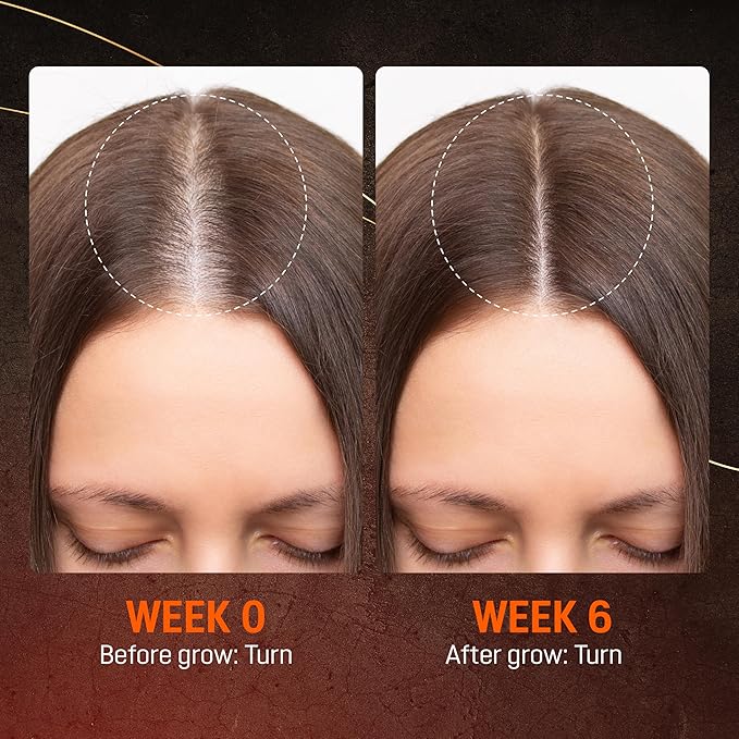 Abera Hair Growth Serum for Hair Loss, Natural Hair Regrowth Treatment for Hair & Beard with Biotin & Castor Oil, Recommended Combo (1 Serum + Gift)